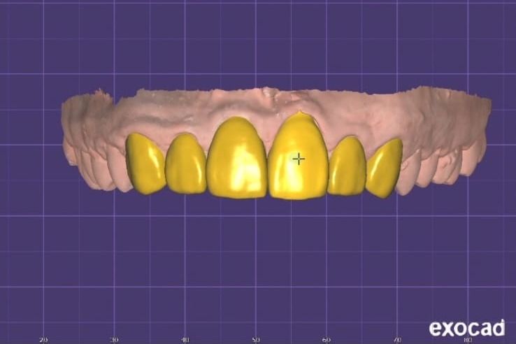 Sebastián Vicente-5