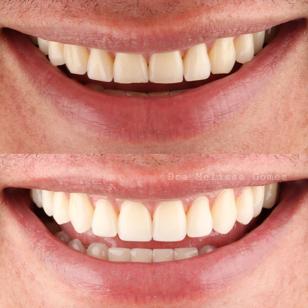 Melissa Gómez Arango-19