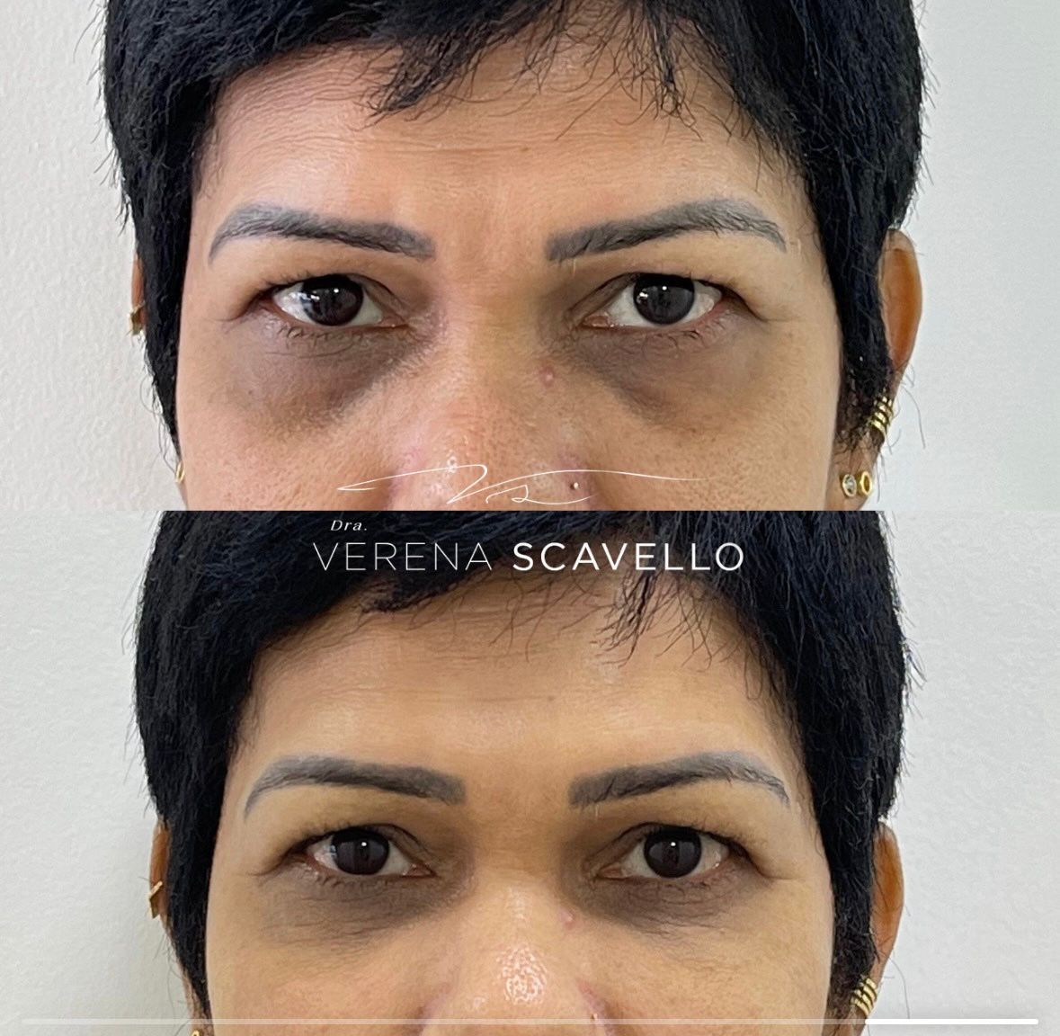 Verena Scavello-7