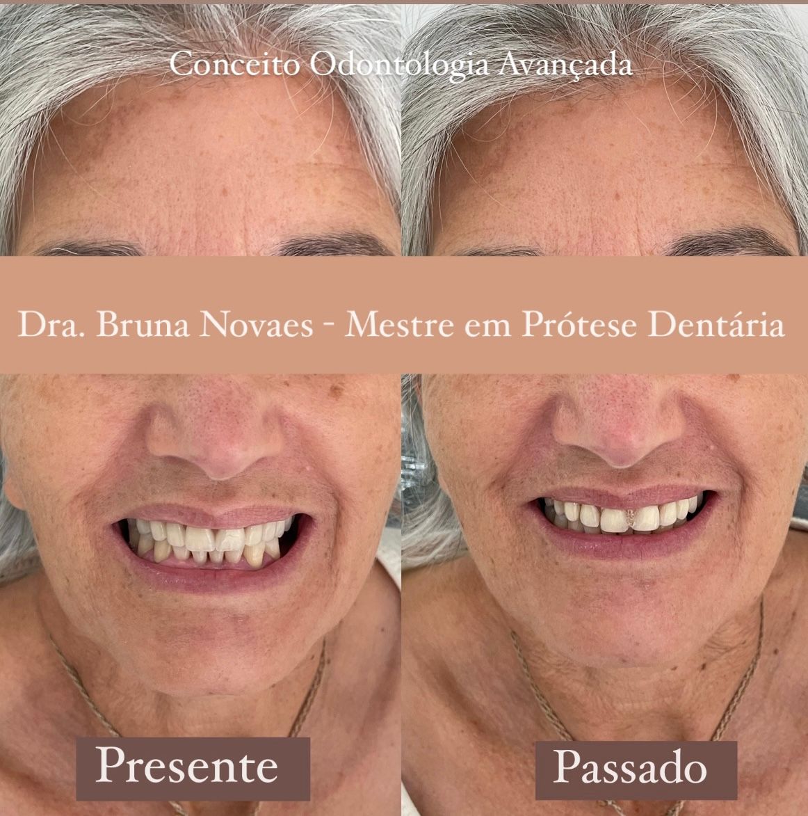 Bruna Novaes Rossini-2