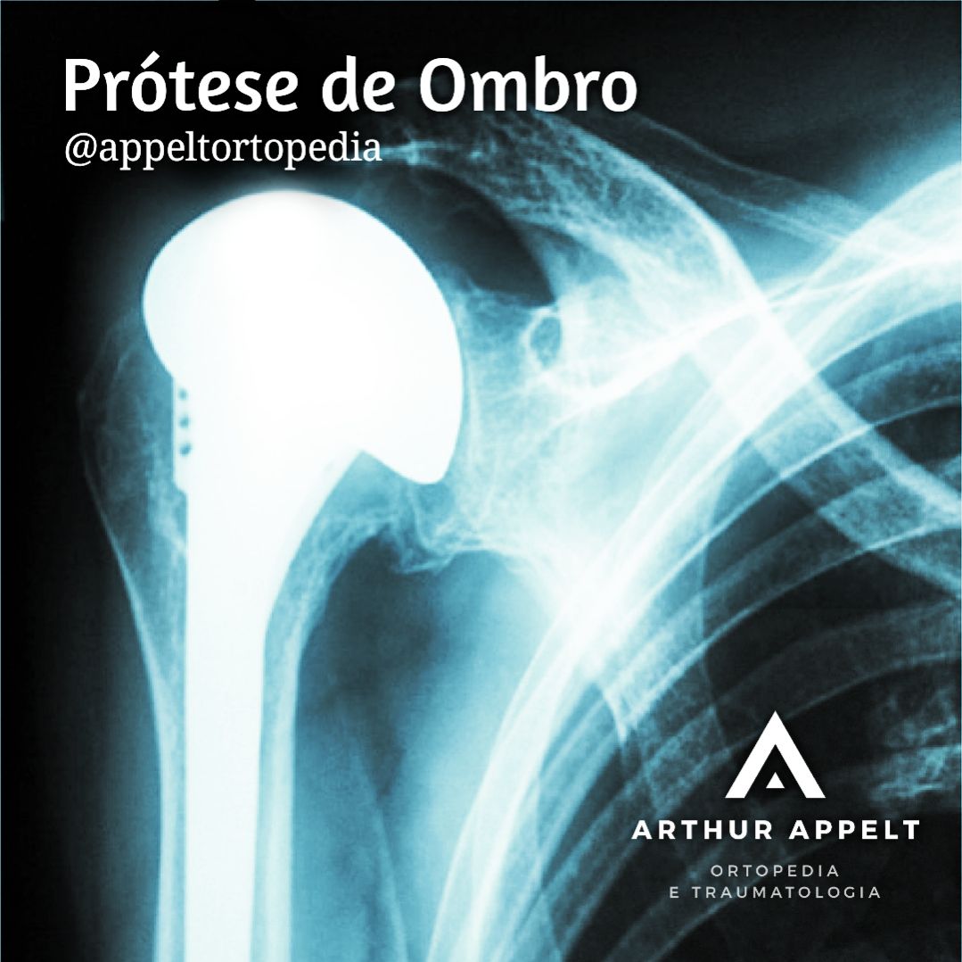 Arthur Lanna Appelt-5