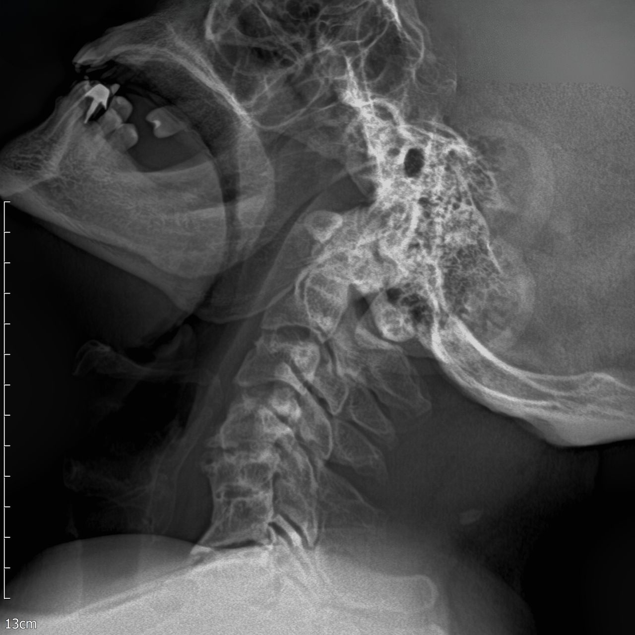 David Tafur Muñoz-1279