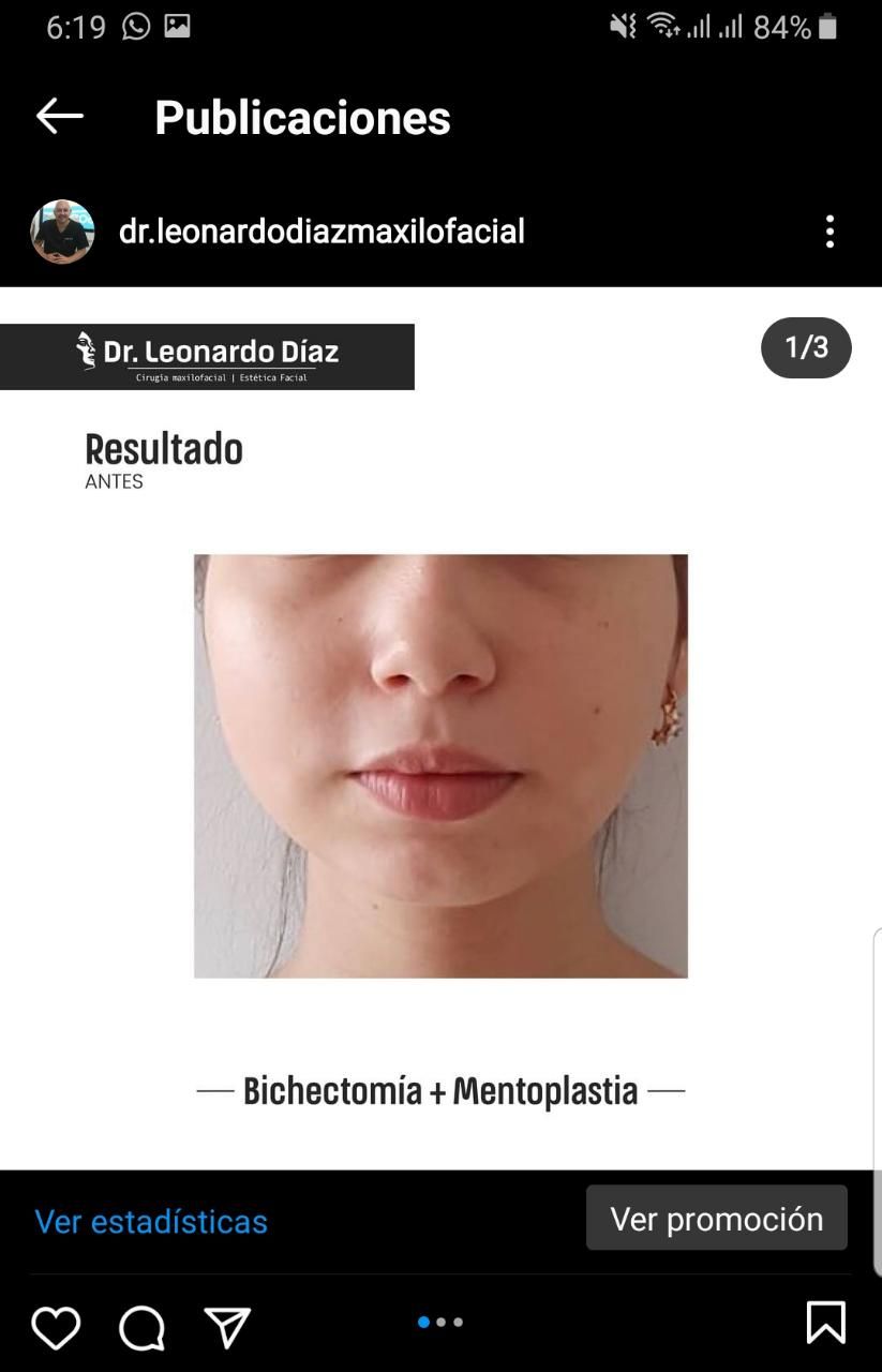 Leonardo Diaz Martínez-10