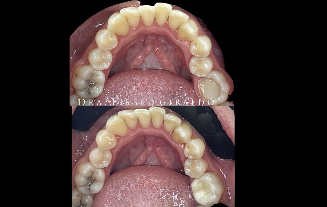 Lisbed Giraldo Olarte-24