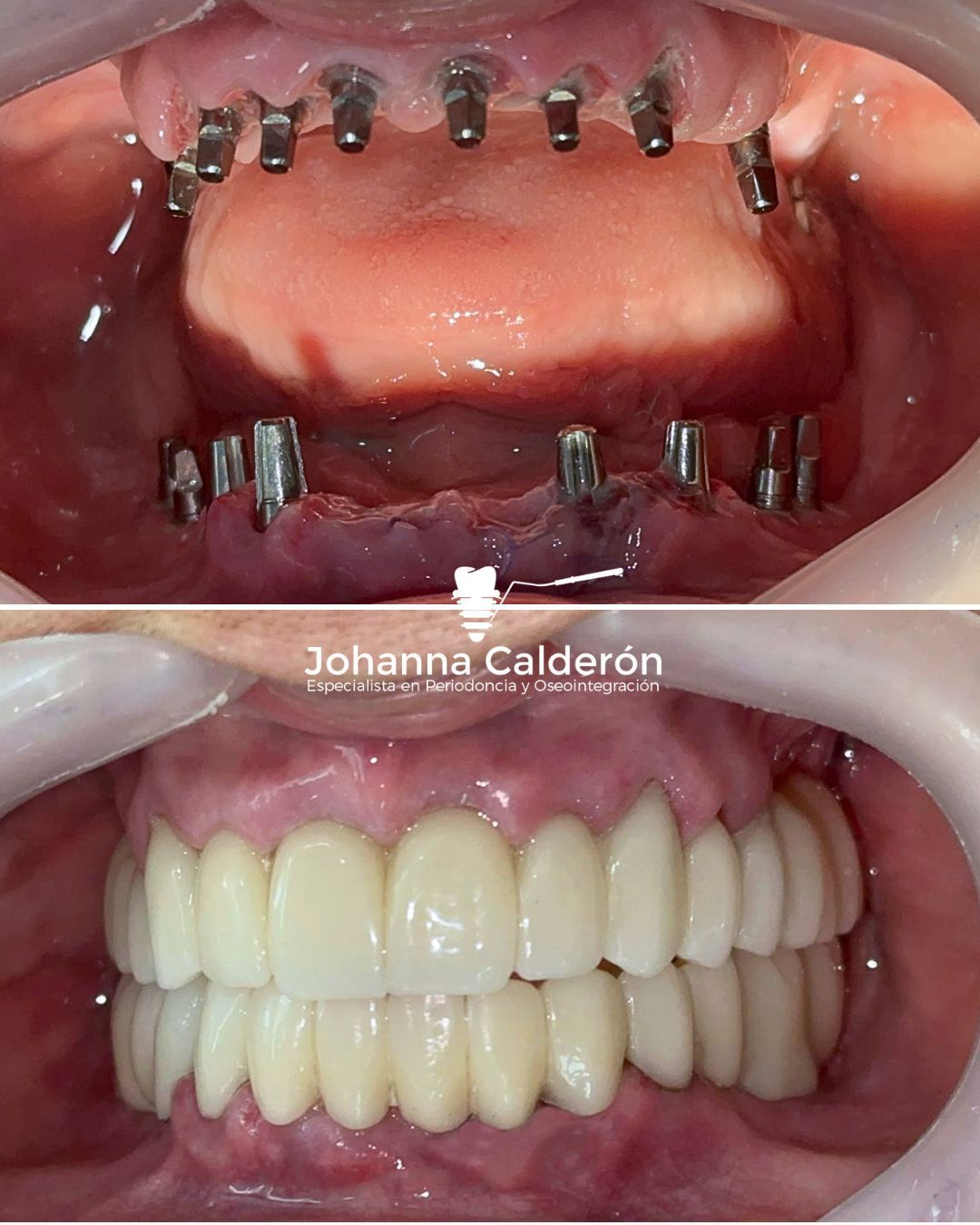 Johanna Andrea Calderón Bohorquez-7