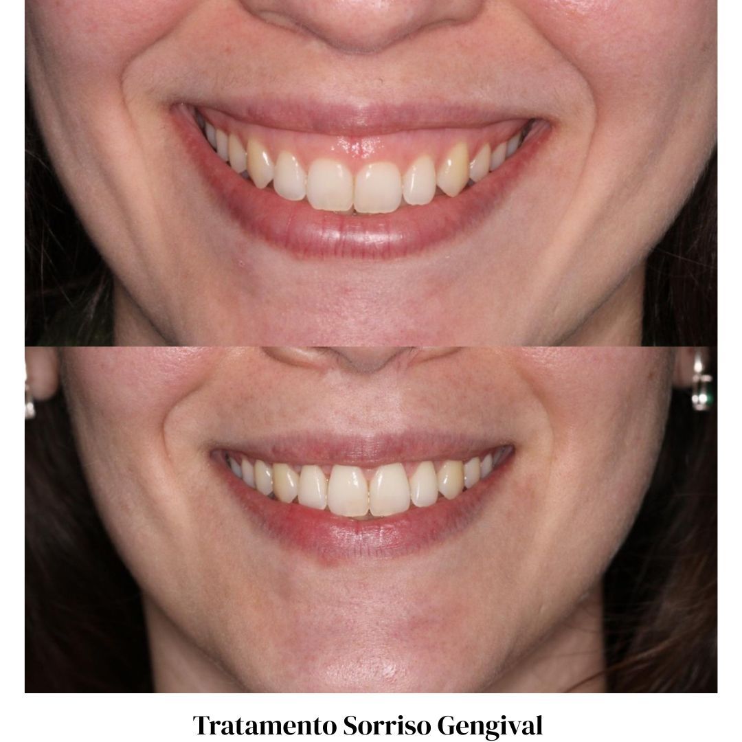 Gabriel Lucio Calazans Duarte-3