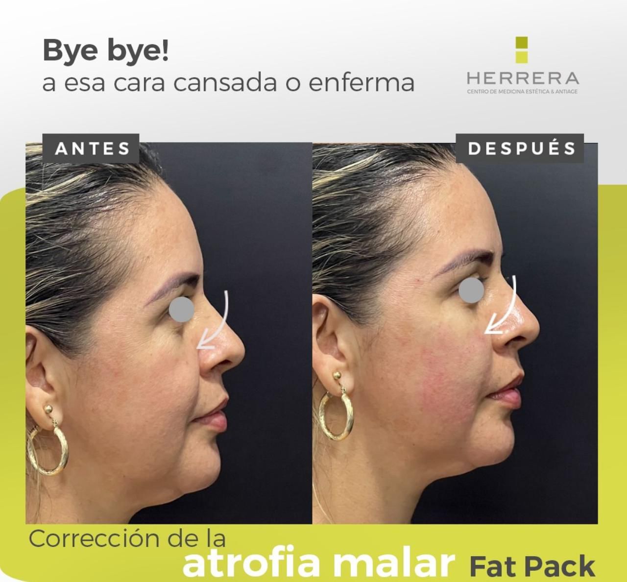 Andrea Alonso Herrera-5