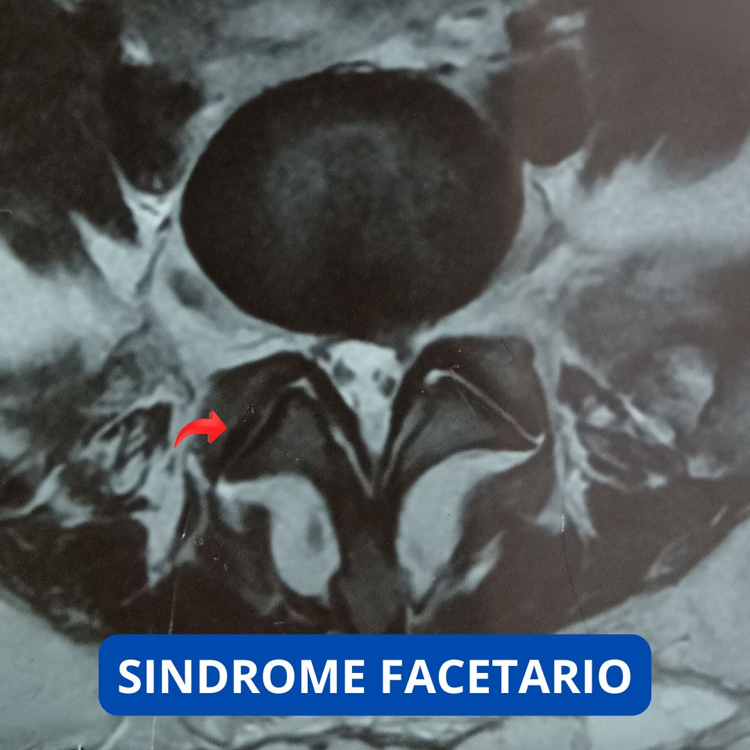 David Tafur Muñoz-2245