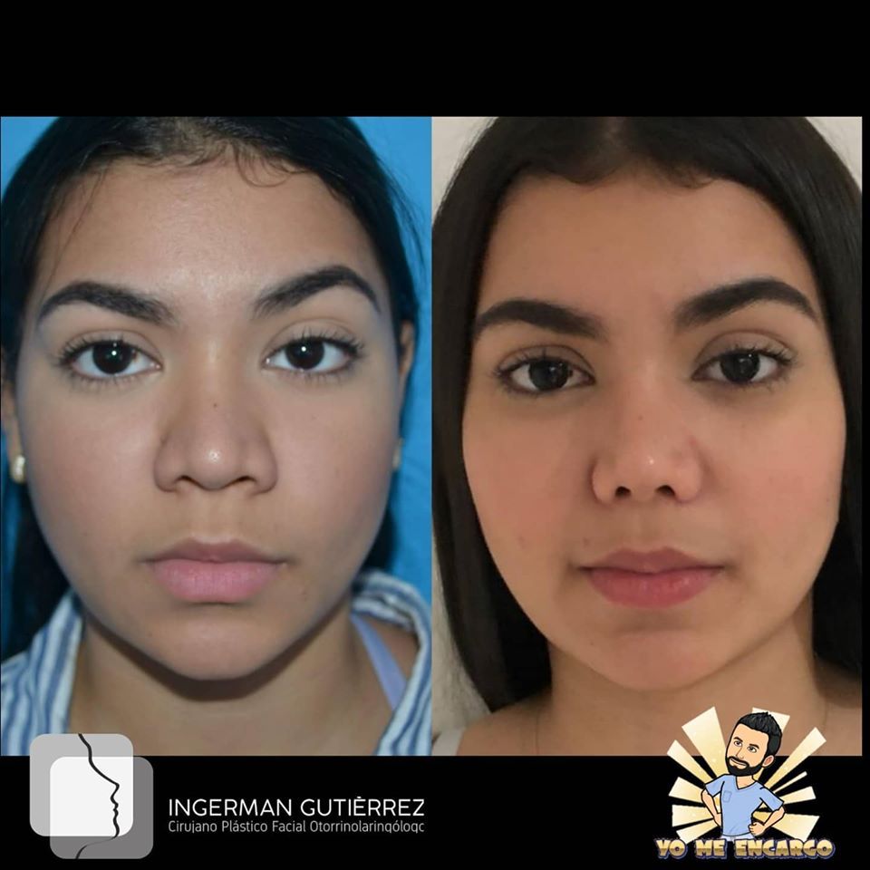 Ingerman Gutiérrez González-5