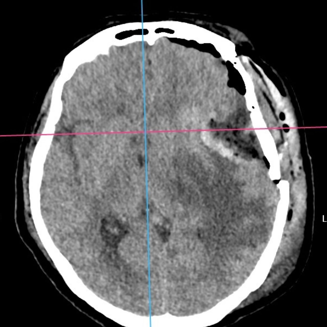 David Tafur Muñoz-1414