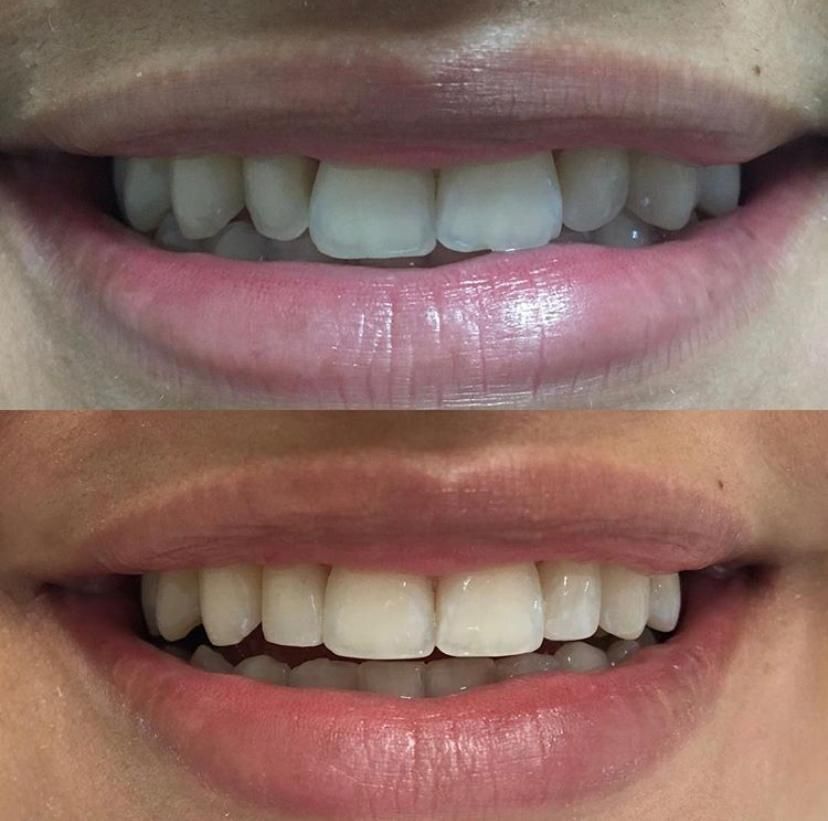 Nayara Fraga De Miranda-23