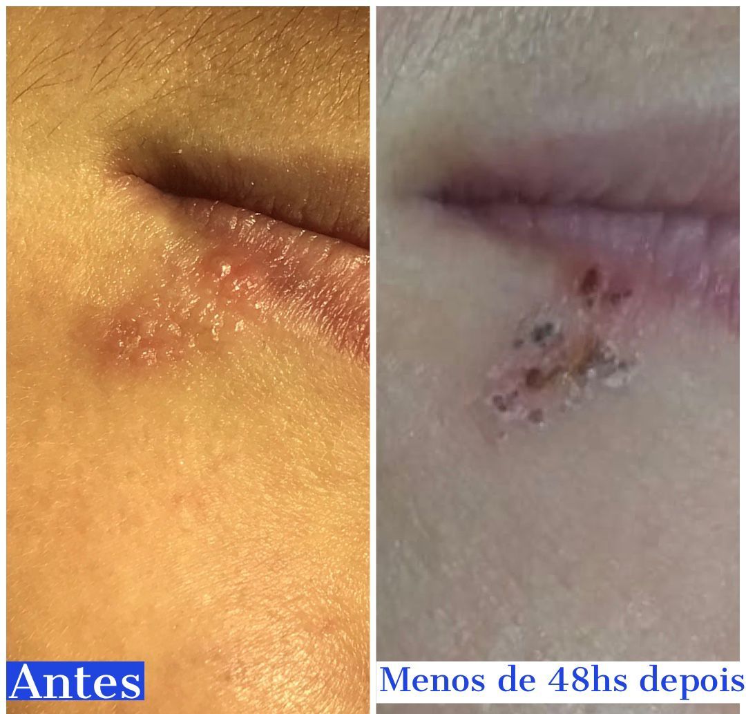 Francisco De Assis Almeida Lima Júnior-18