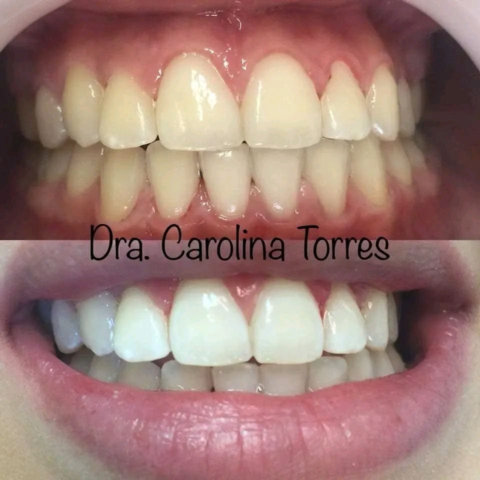 Carolina Alejandra Torres Acuña-6