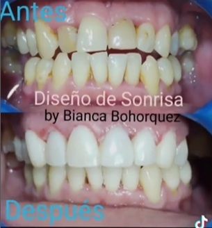 Bohorquez Prieto Bianca Daniela-2