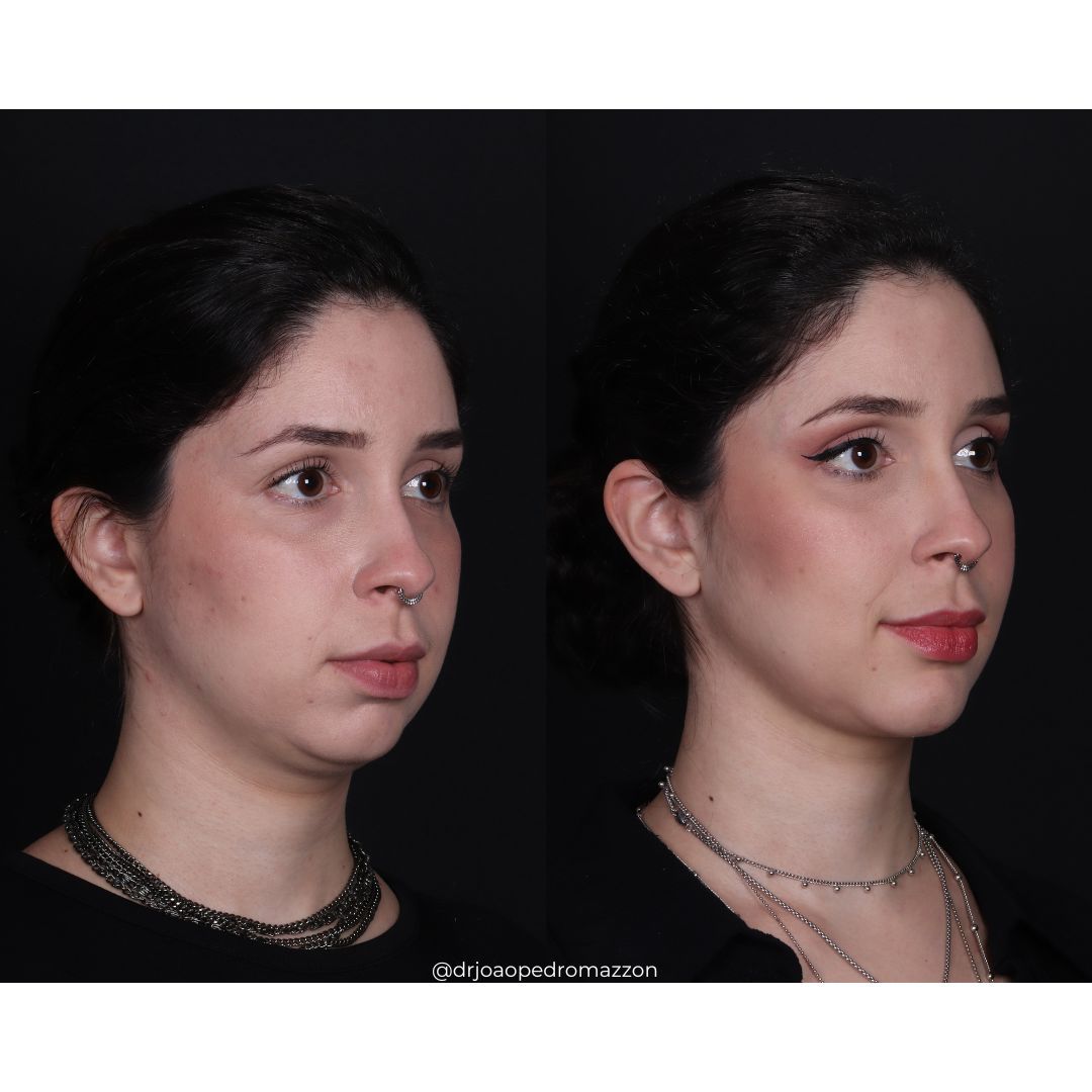 João Pedro Paulino Mazzon-25