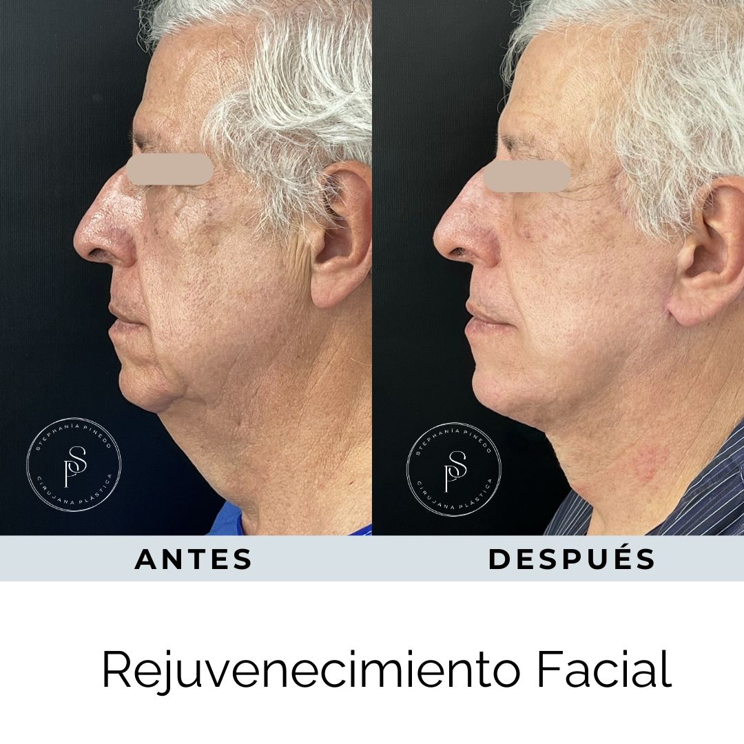 Stephanía Pinedo García-15