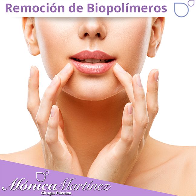 Maria Monica Martinez Martinez-26