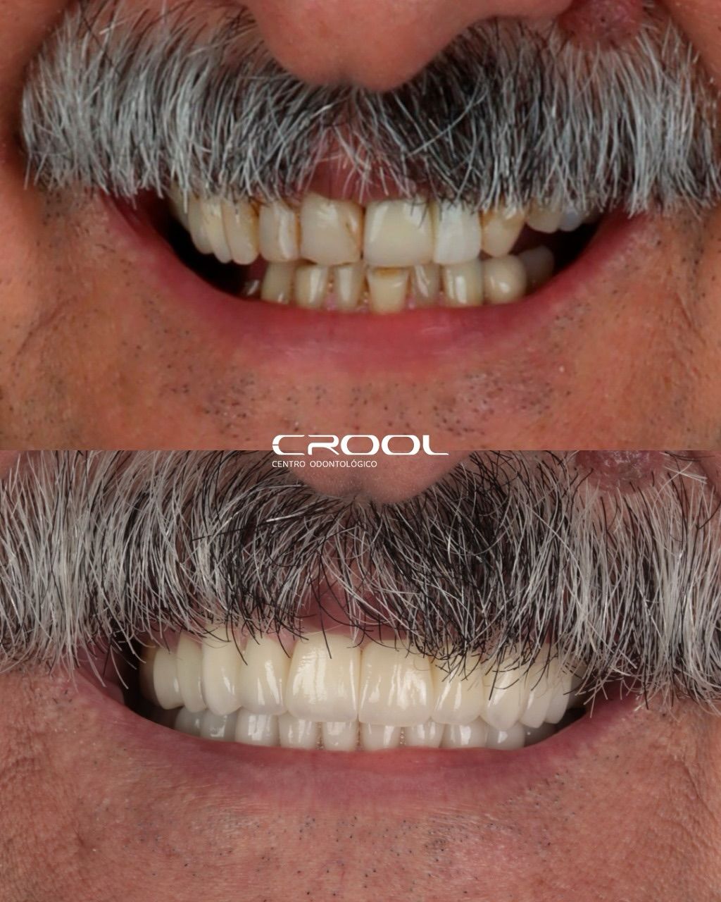 Frederico  Coelho-12