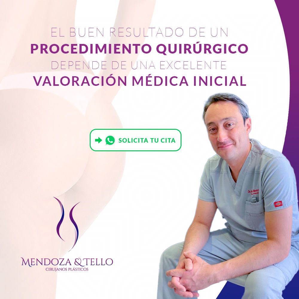 Alexander Mendoza-20