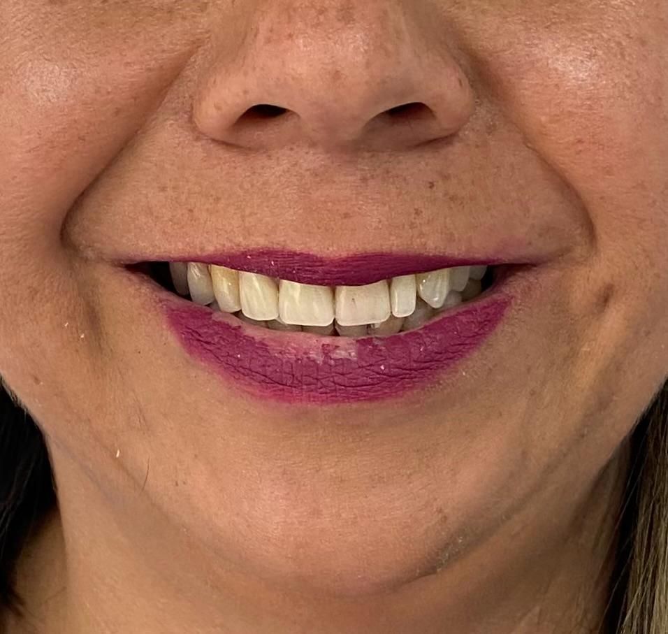 Francisco Bahamonde-13