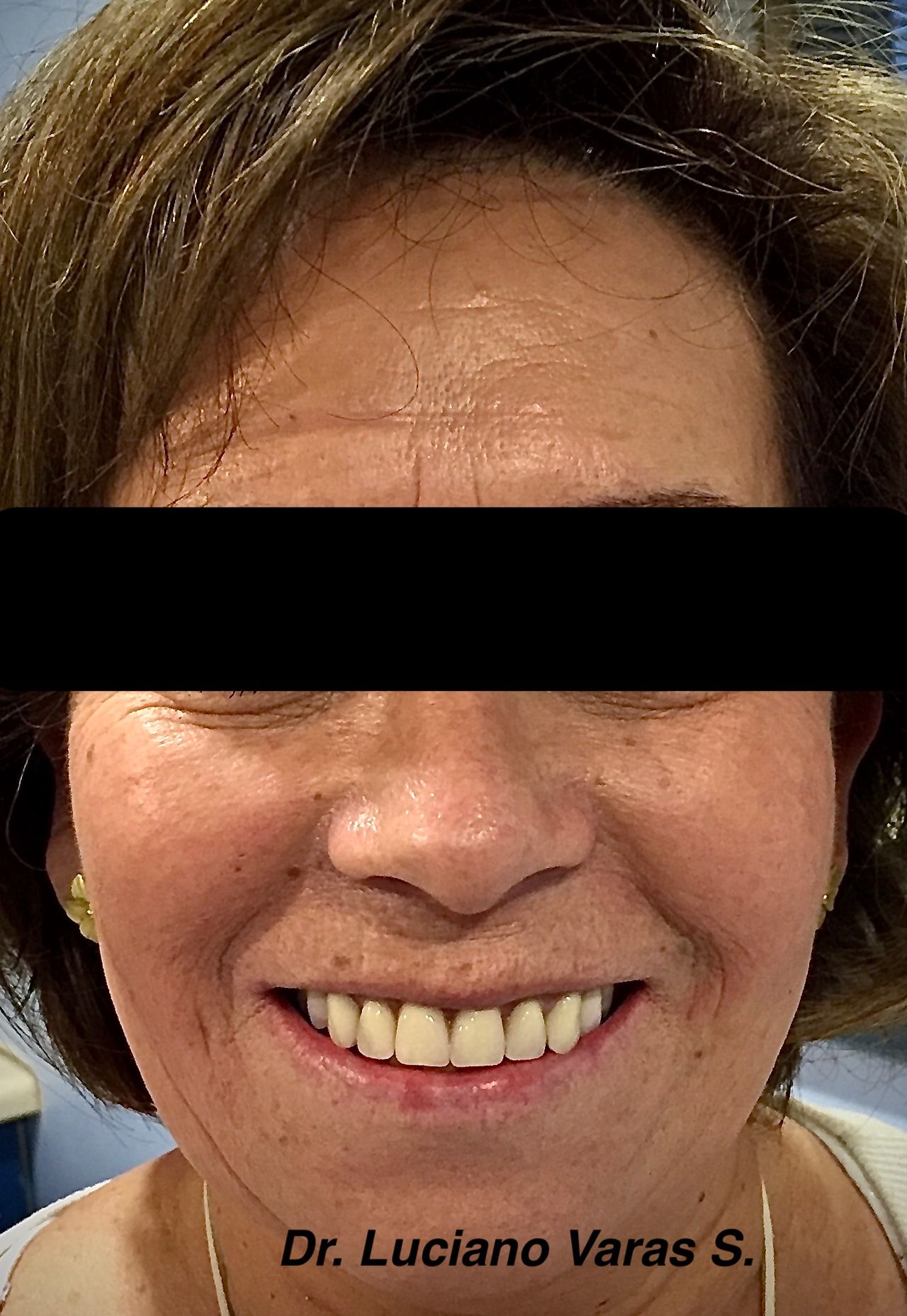 Luciano Varas Salinas-17