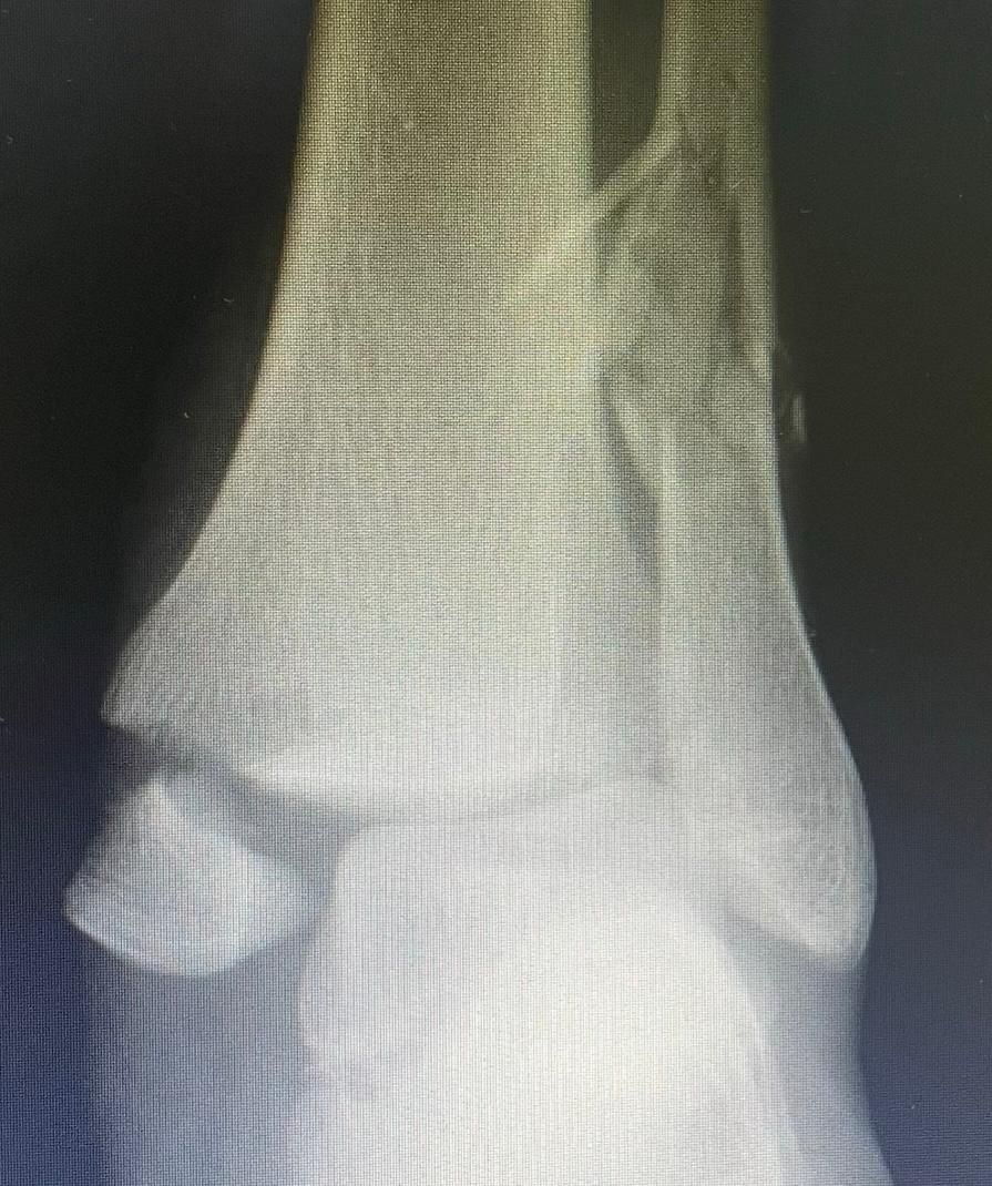 Jônatas Laurindo Giacomini-18