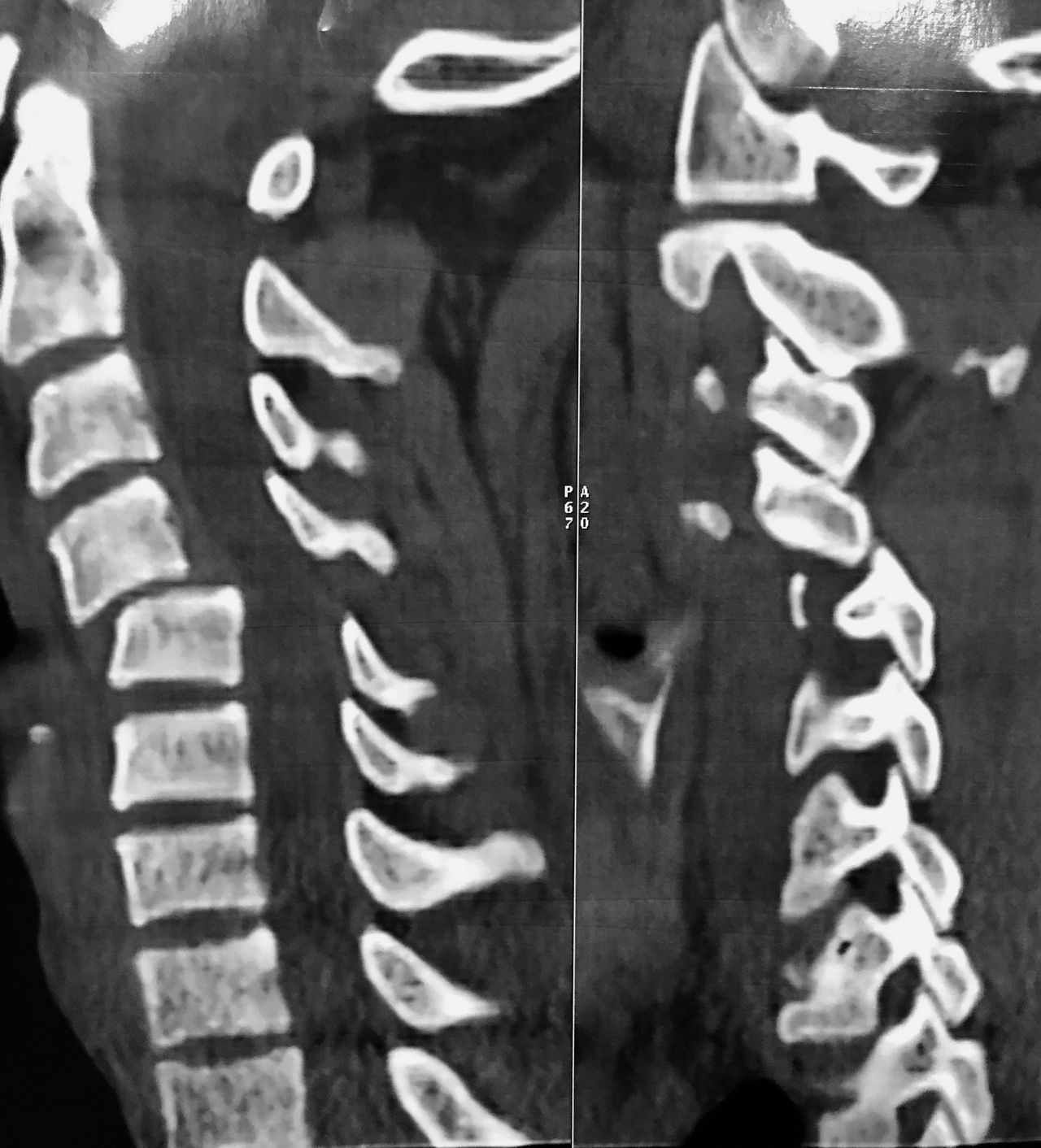 José Lopes Sousa Filho-28