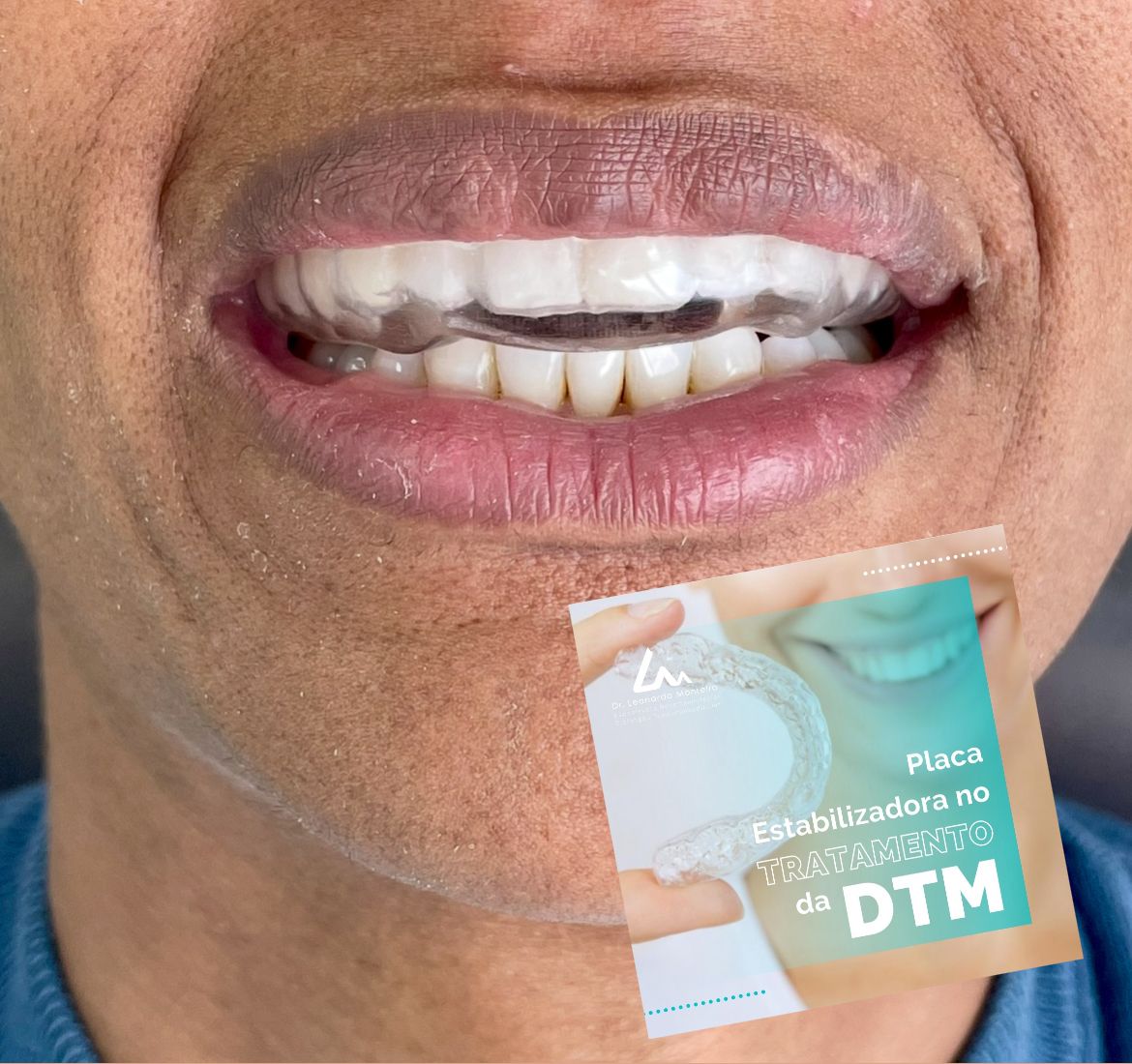 Leonardo Monteiro-20