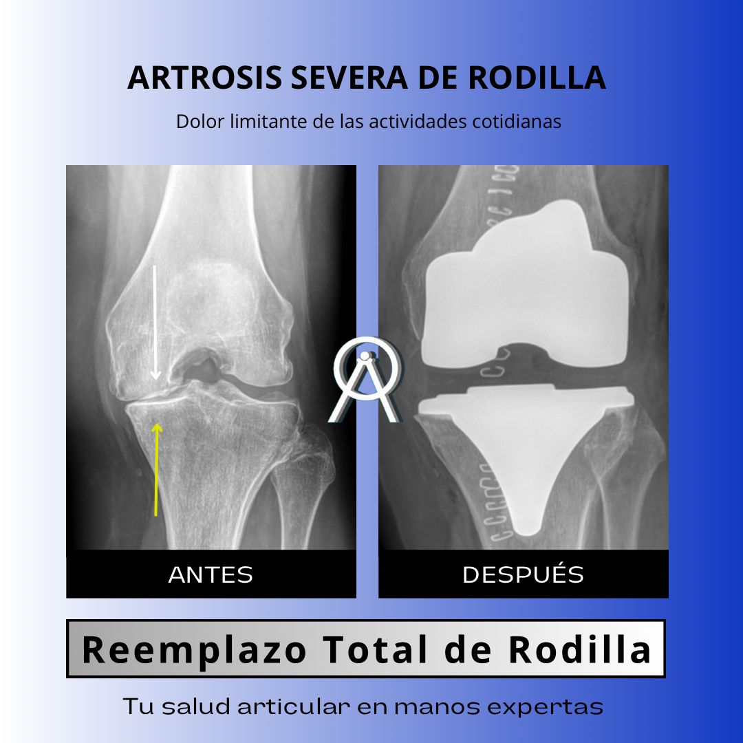 Alejandro Argüello Arevalo-0