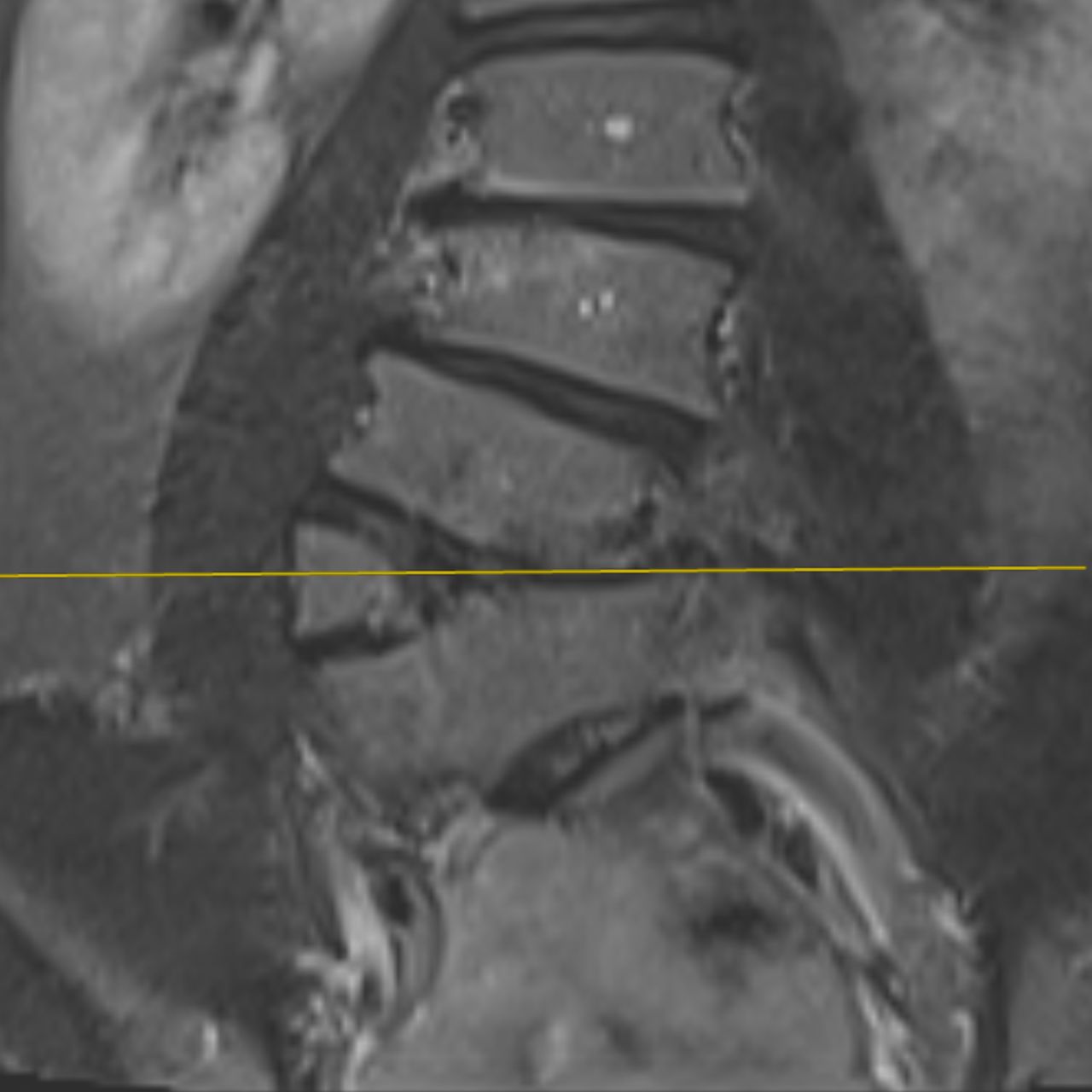 David Tafur Muñoz-1965