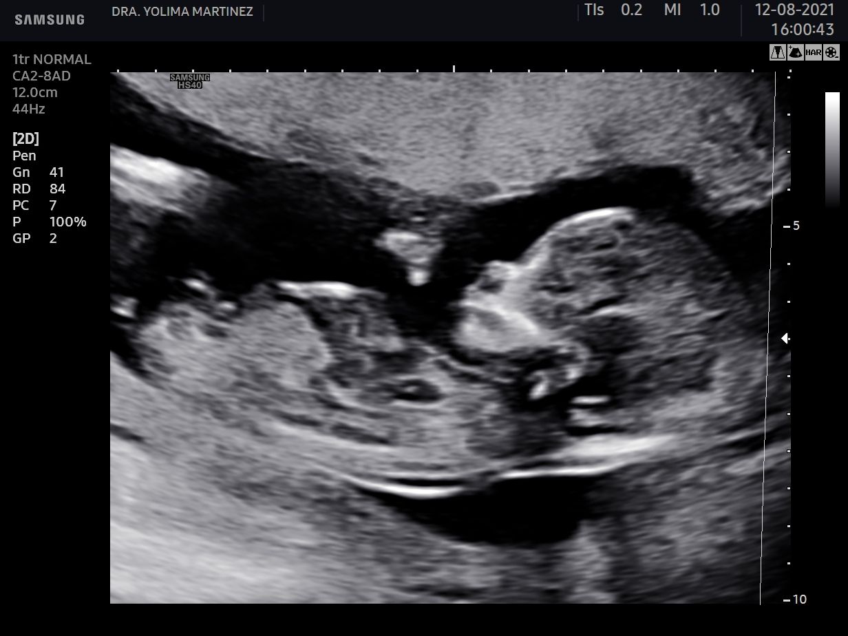 Mercy Yolima Martínez Velásquez-4