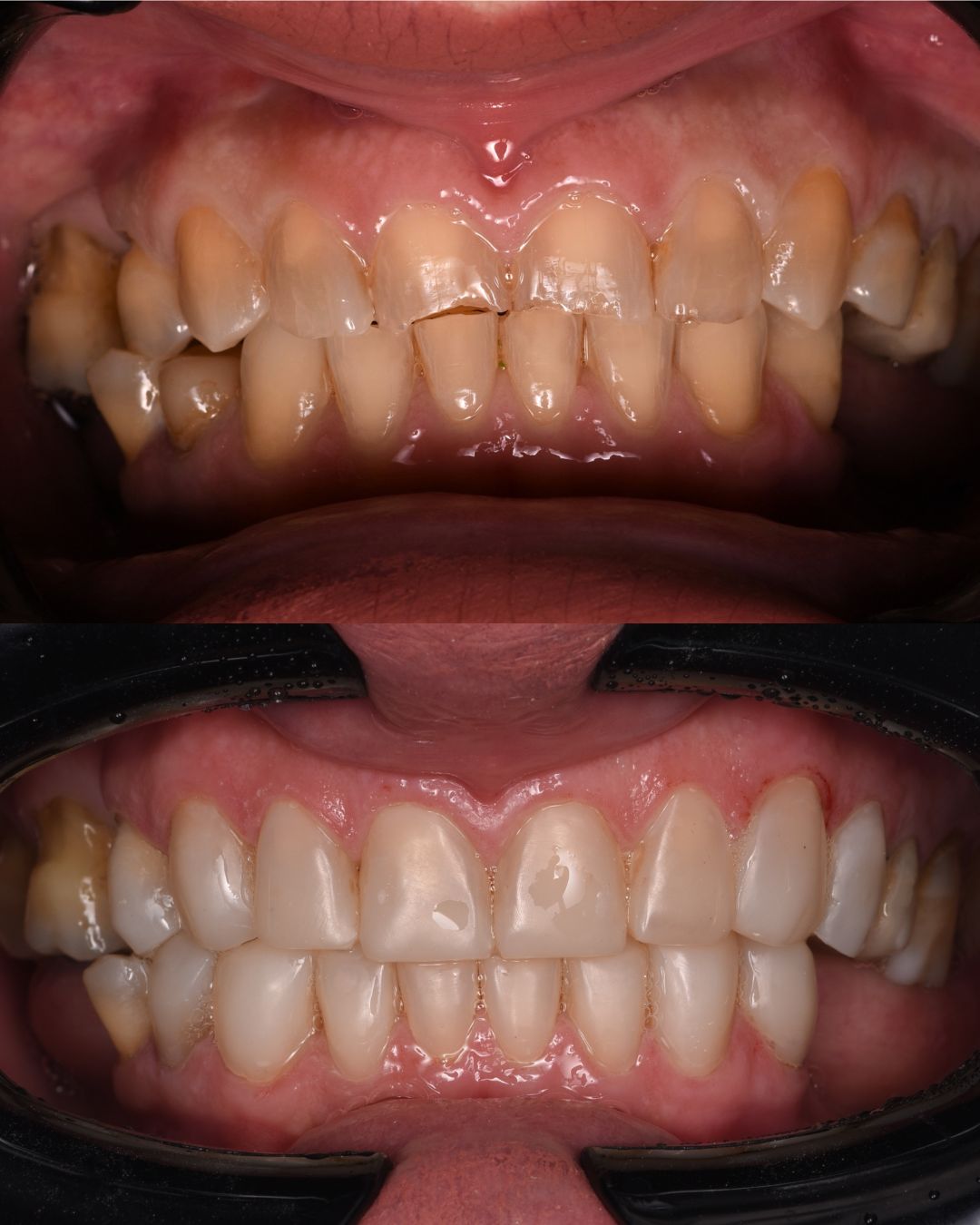 Andrés Verdugo Bolumburu-8