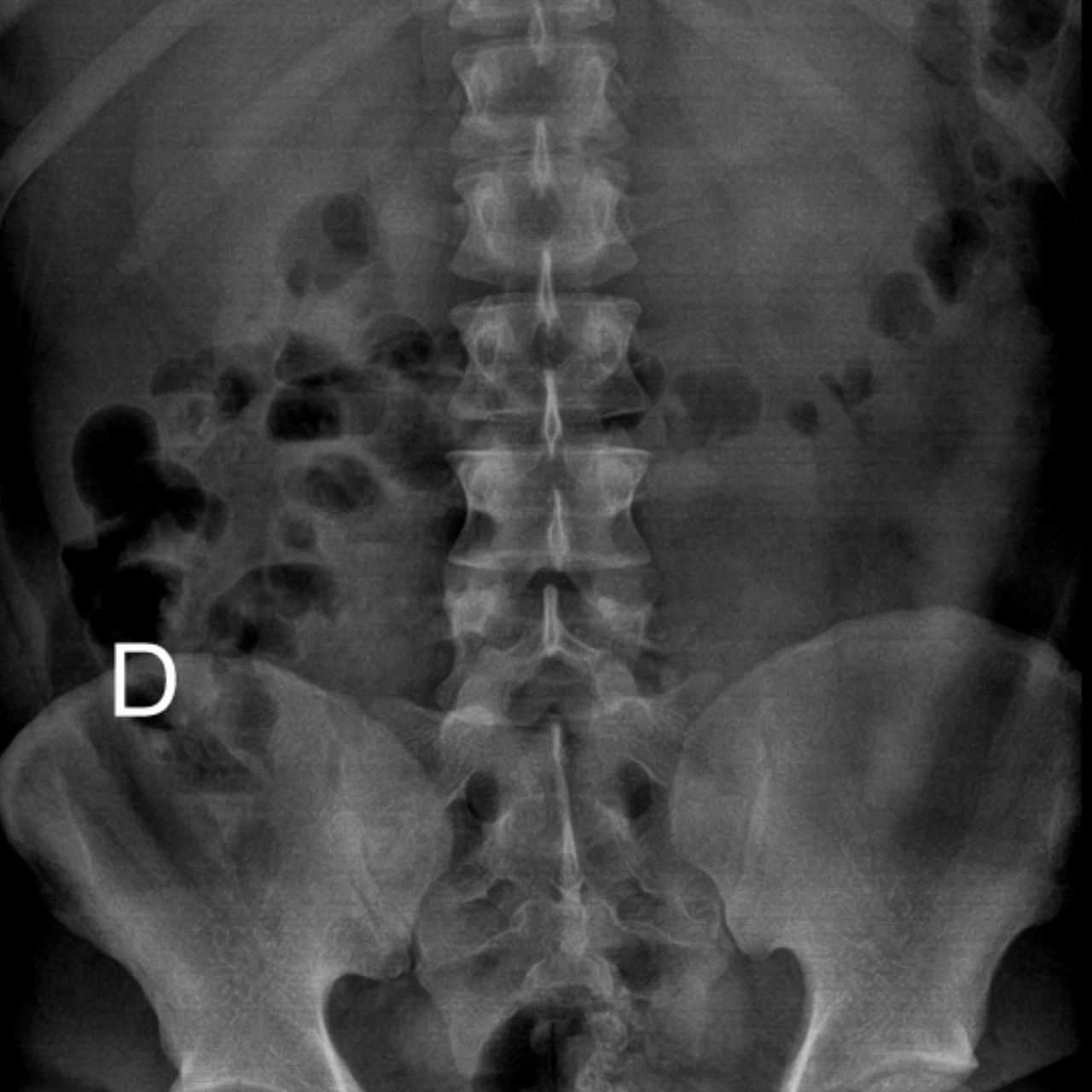 David Tafur Muñoz-2386