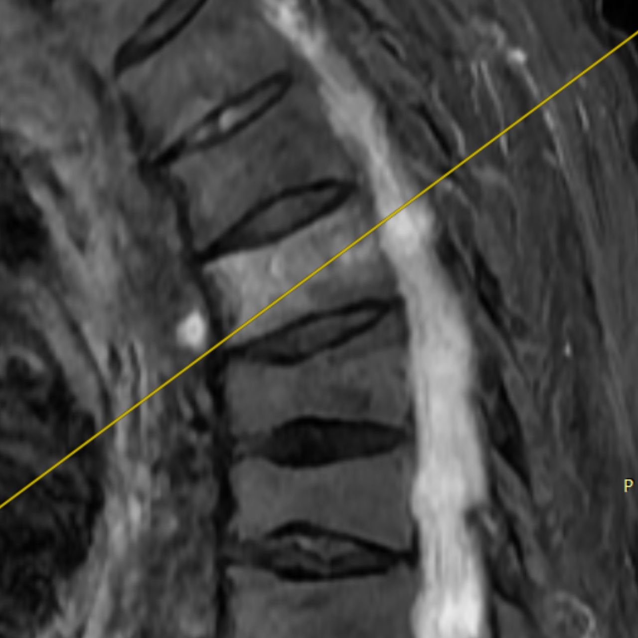David Tafur Muñoz-1600