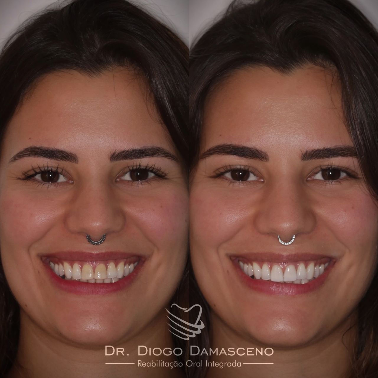 Diogo Damasceno-45