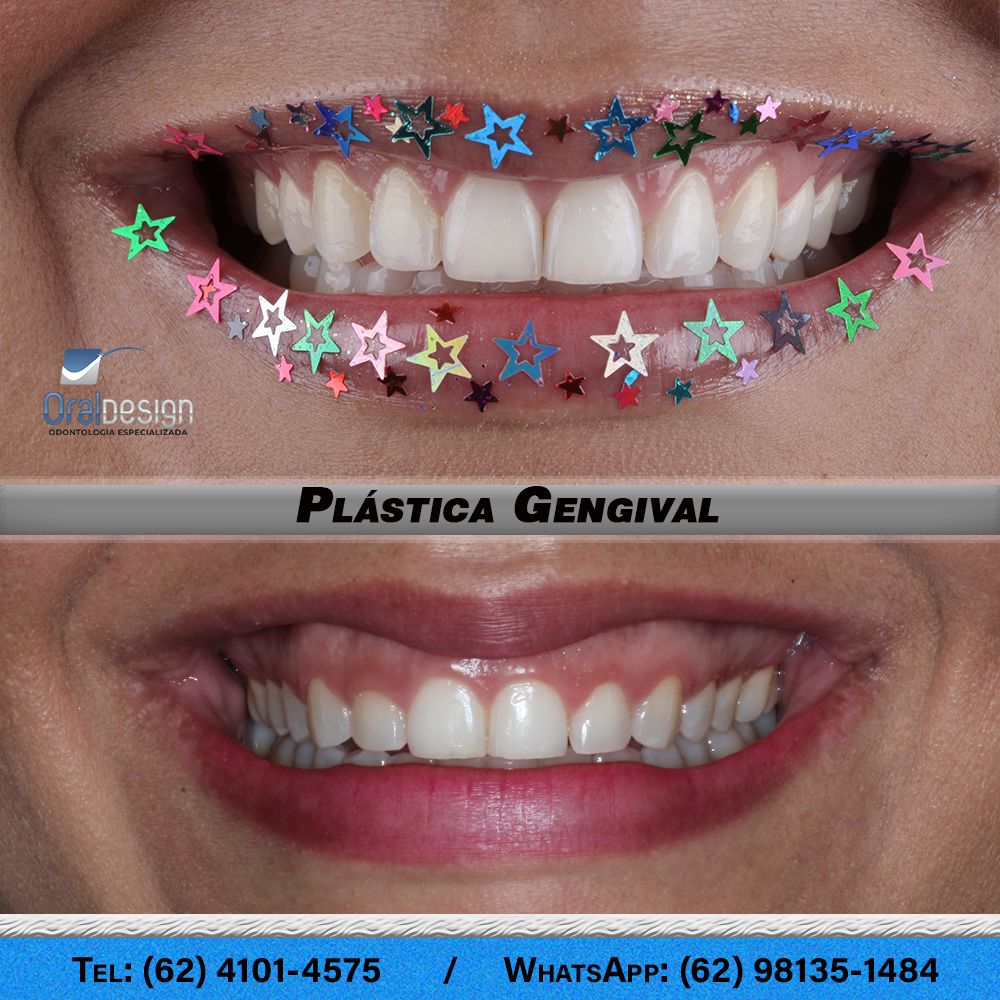 Danilo Monteiro Rezende Pereira-4