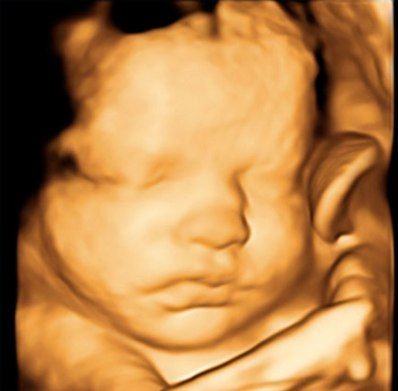 Maritza Rodriguez Balanta-10