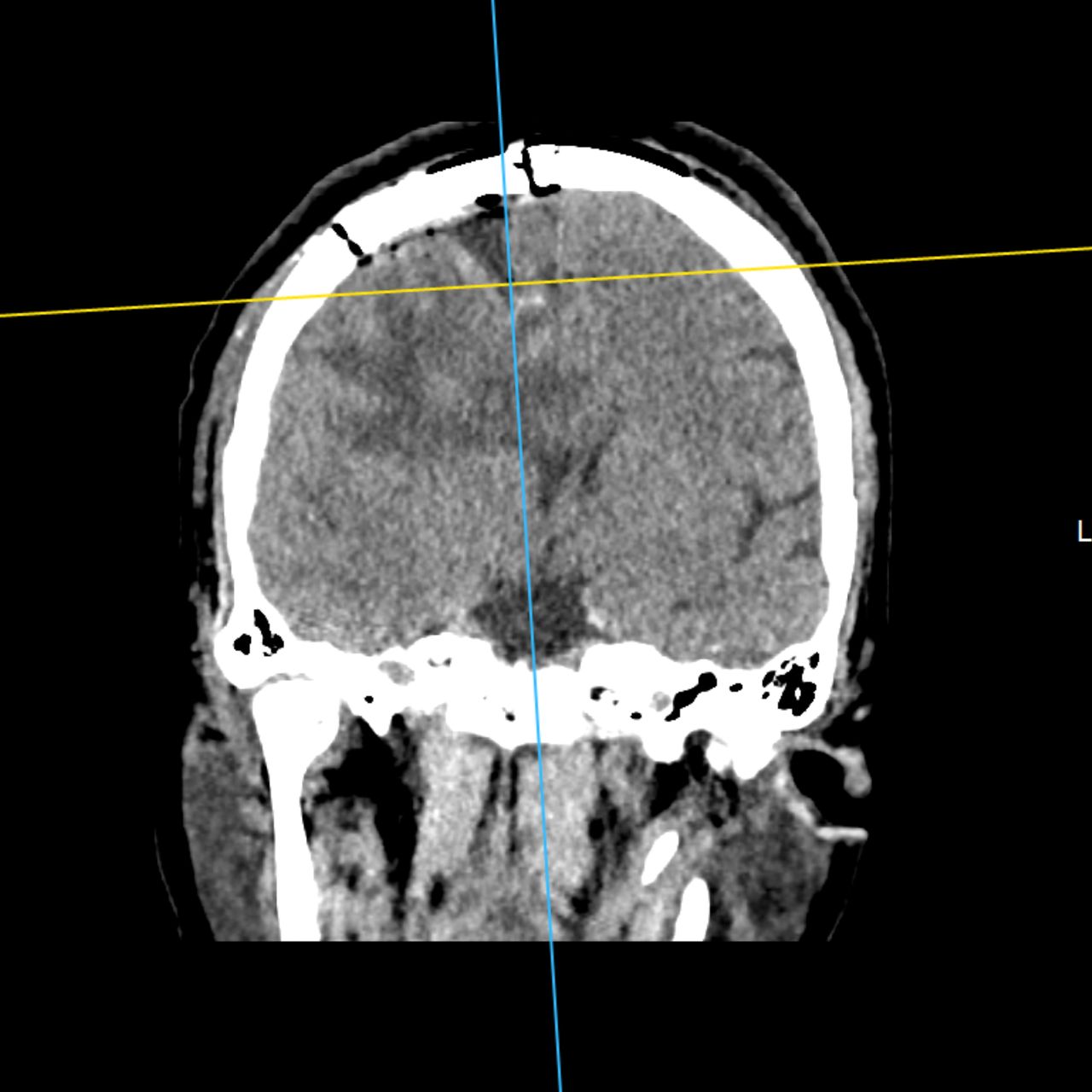 David Tafur Muñoz-2044