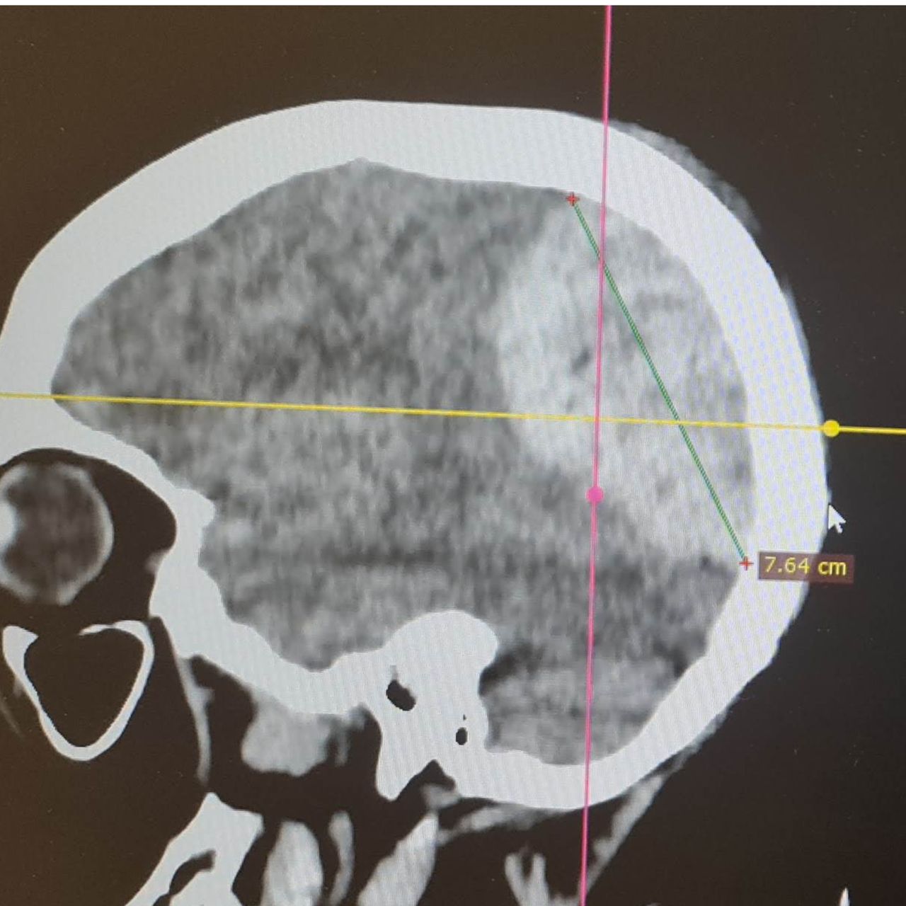 David Tafur Muñoz-1210