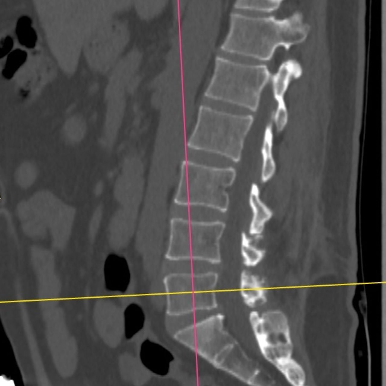 David Tafur Muñoz-1740