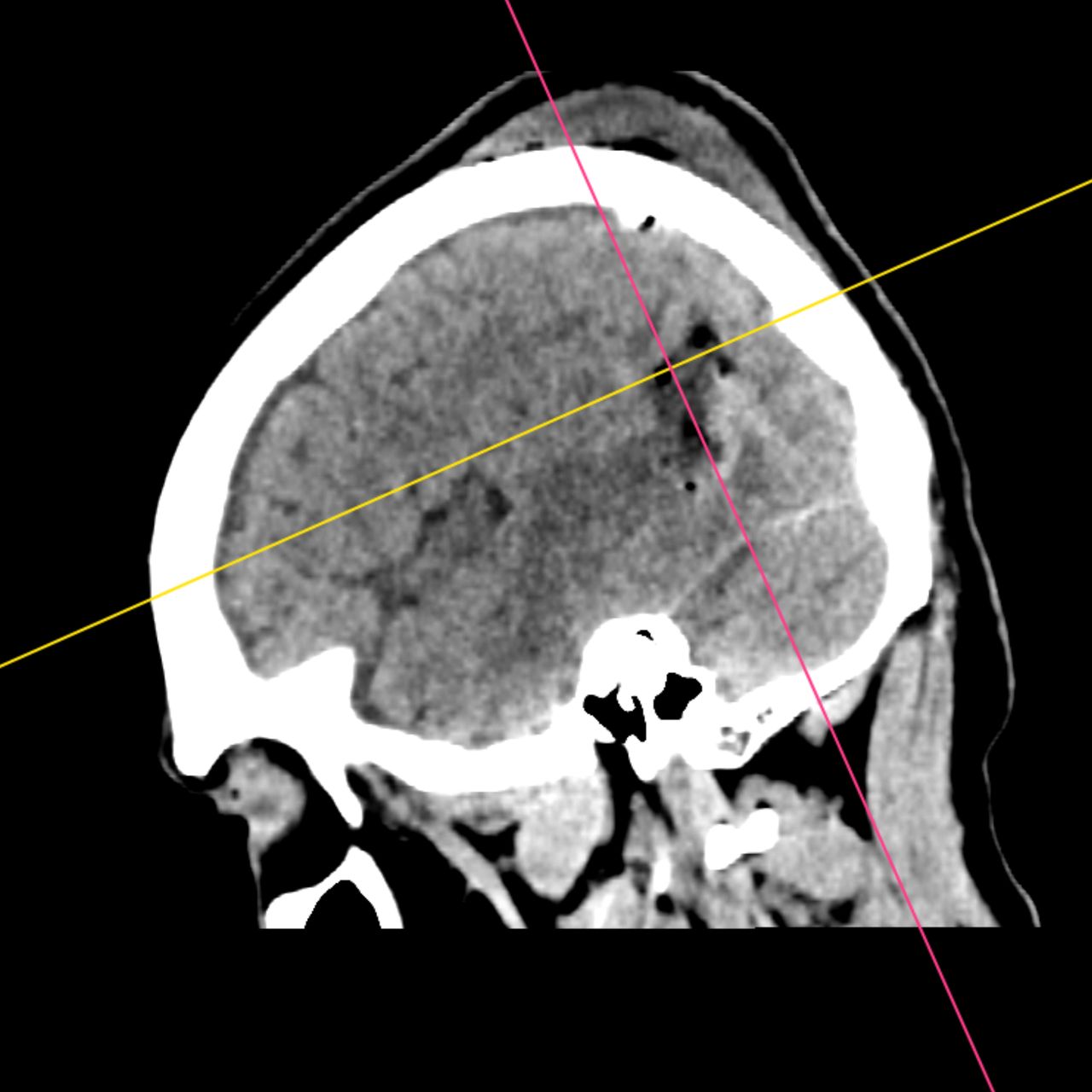 David Tafur Muñoz-1995