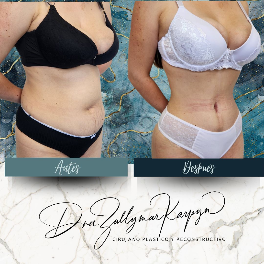 Zullymar Karpyn Brito-7