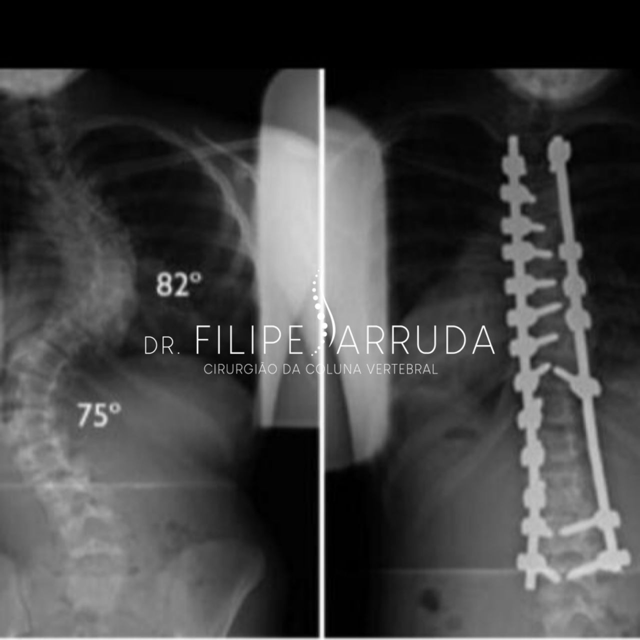 Filipe Arruda-15