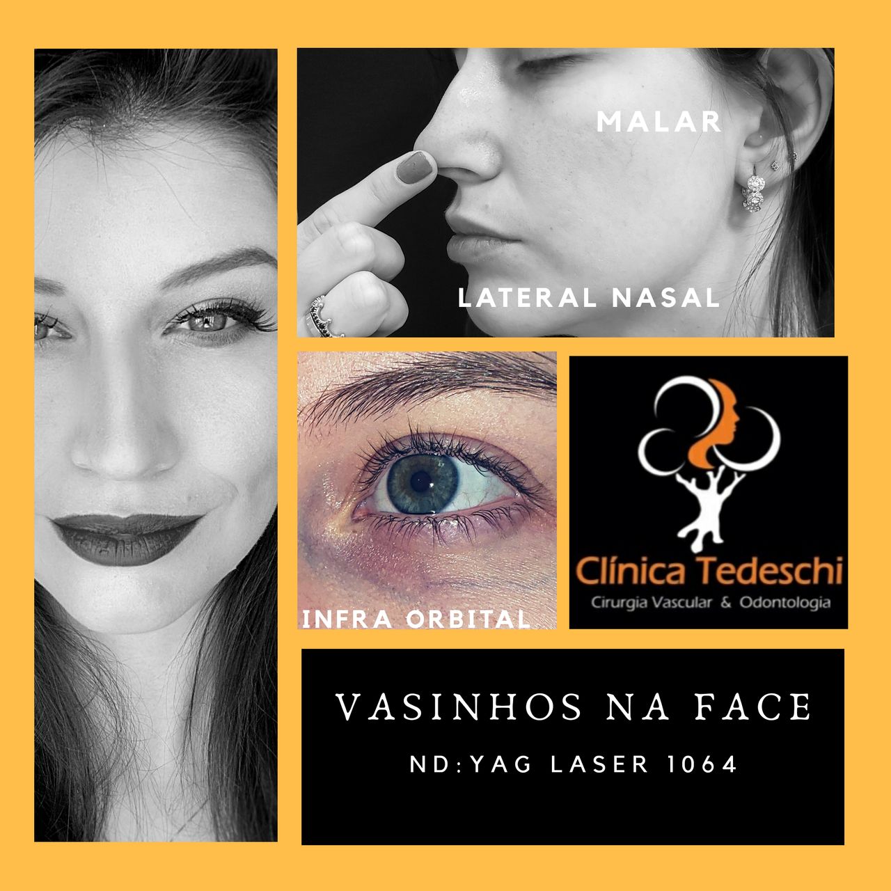 Wagner Tedeschi Filho-5