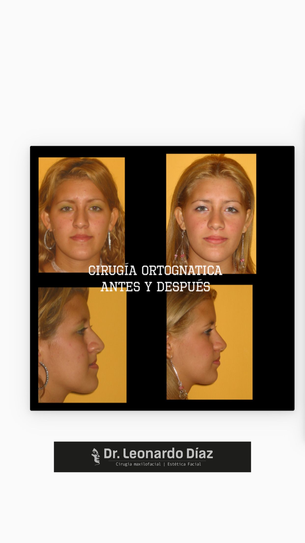 Leonardo Diaz Martínez-12