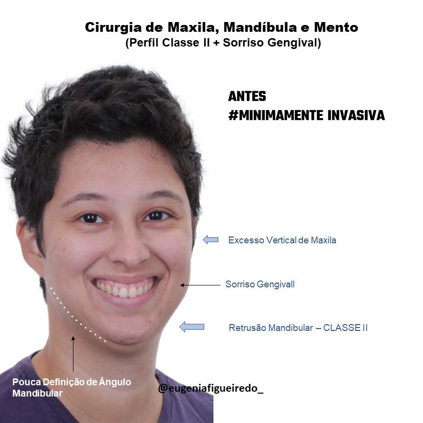 Eugênia Figueiredo-22