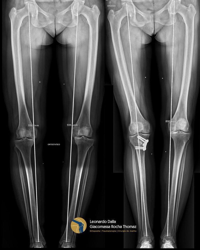 Leonardo Dalla Giacomassa Rocha Thomaz-3