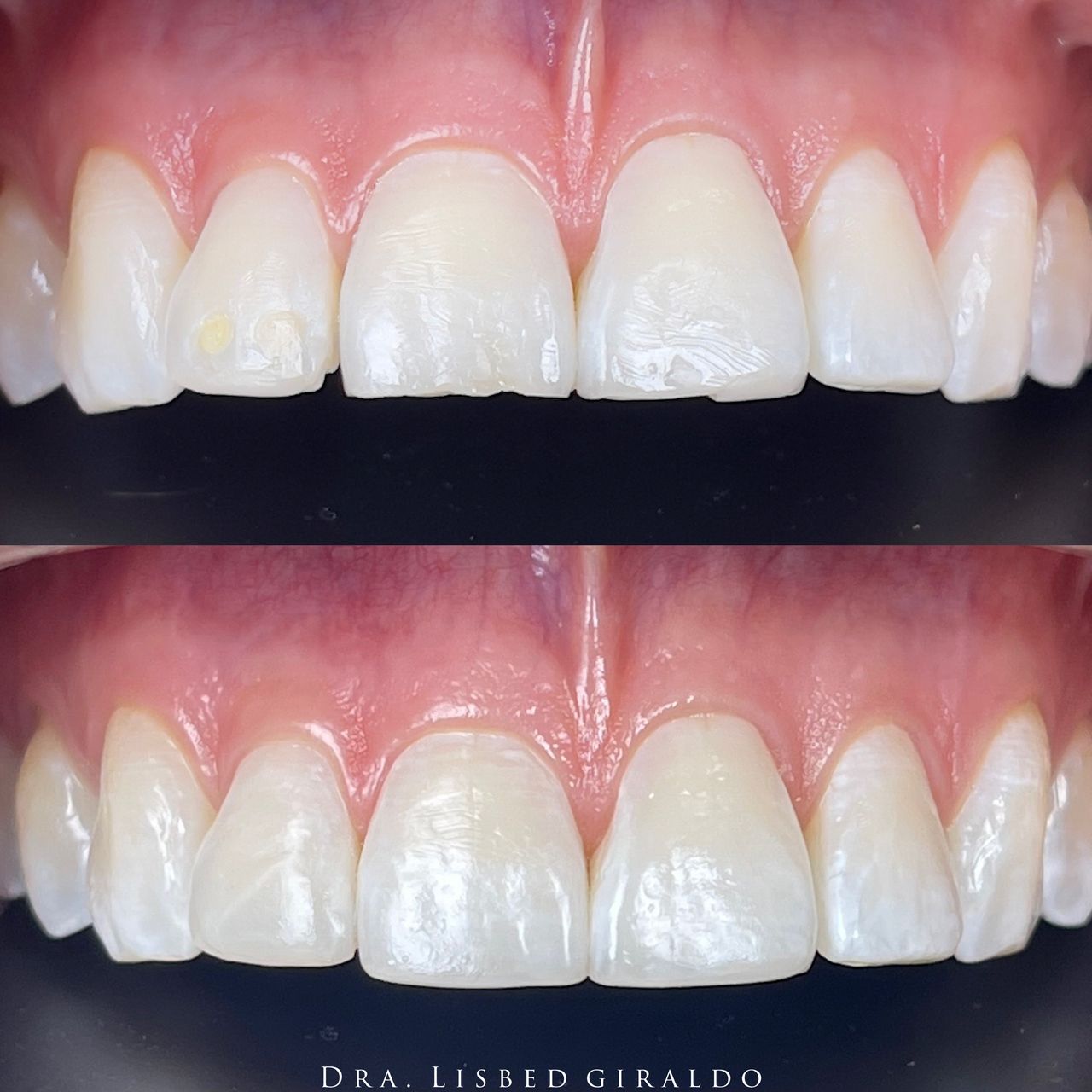 Lisbed Giraldo Olarte-17