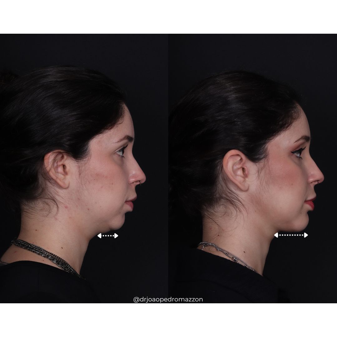 João Pedro Paulino Mazzon-24