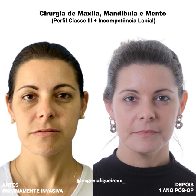Eugênia Figueiredo-28